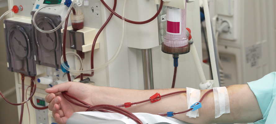 O que é a Hemodiálise? A Hemodiálise é para toda a vida?