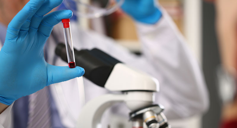 analises clinicas nefrovida dialise